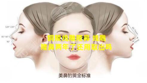 铜陵线雕隆鼻 线雕隆鼻两年了还用取出吗